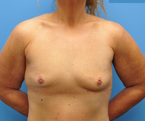 gallery before image