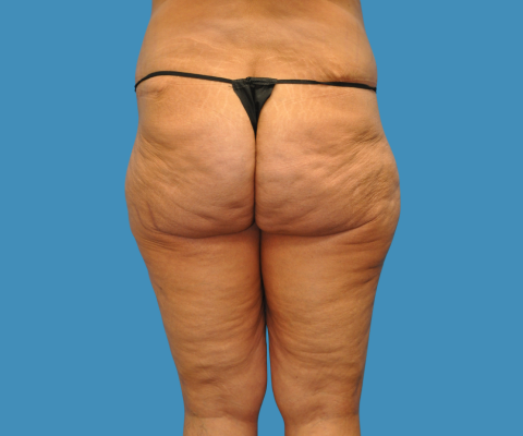 gallery before image