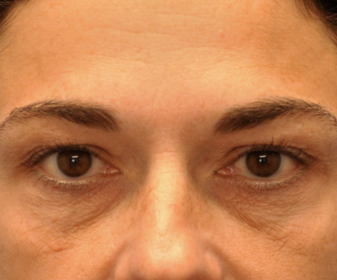 gallery before image