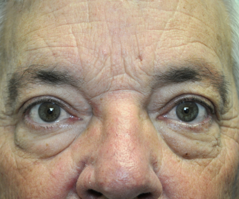 gallery before image