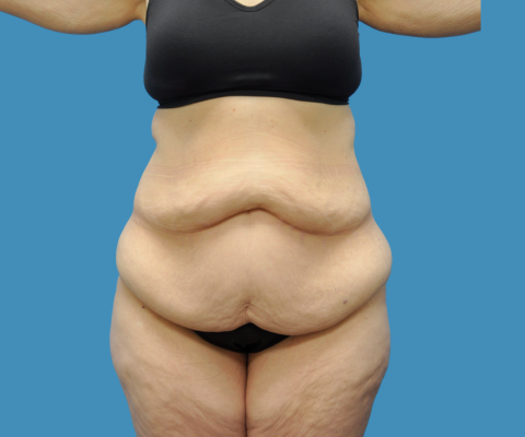 gallery before image