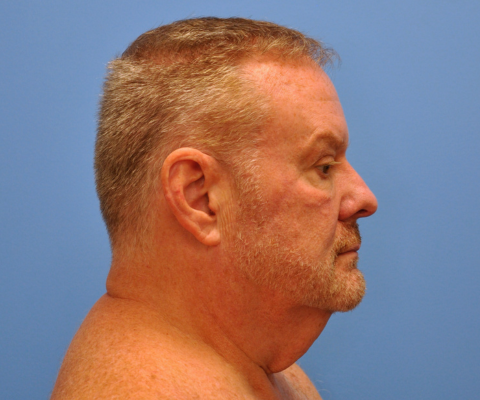 gallery before image