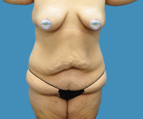 gallery before image