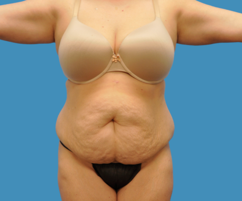 gallery before image