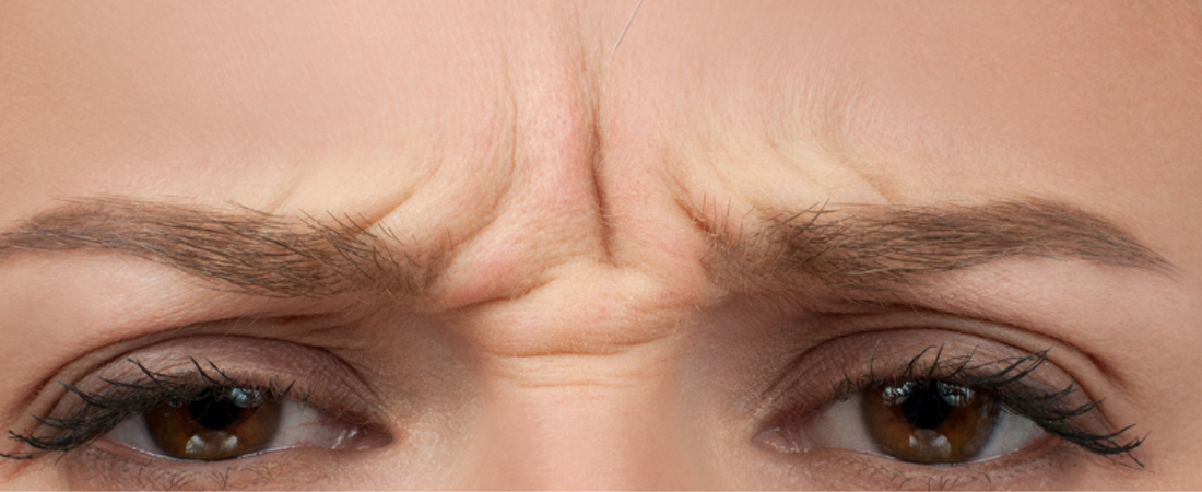 Botox vs. Fillers What's the Difference? image